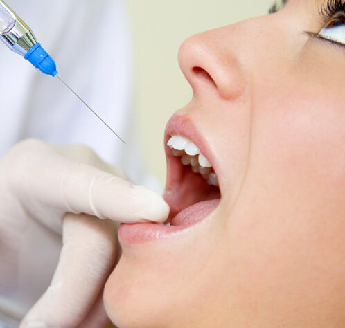 anestesia dentale ars dental