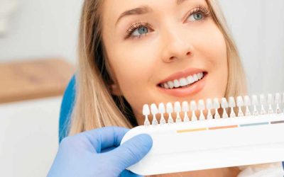 Faccette dentali per un sorriso perfetto
