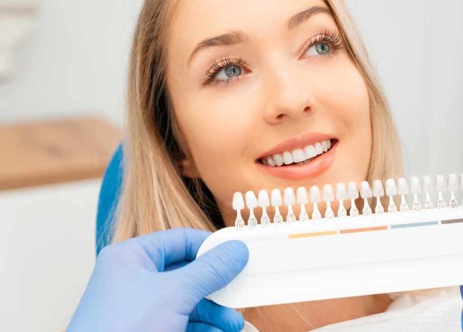 faccette dentali a roma