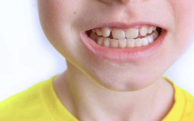 Ortodonzia Pediatrica: La Chiave per il Sorriso dei Più Piccoli